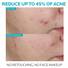 Effaclar Salicylic Acid Acne Treatment Serum